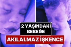 denizlide-kan-donduran-olay-2-yasindaki-bebek-dovulerek-hastanelik-edildi-vgRMmgKB.jpg