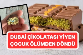 dubai-cikolatasinin-icinden-cikanlar-mide-bulandirdi-olumle-sonuclanabilirdi-jaFEzQ2e.jpg