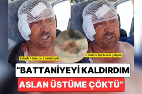 antalyada-hayvanat-bahcesinden-kacan-aslanin-saldirisina-ugrayan-bahtsiz-adam-yasadiklarini-anlatti-RXxhypwz.jpg
