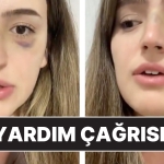 esinden-siddet-goren-bayanin-yardim-daveti-lutfen-sesim-olun-bxN2spLB.jpg