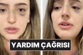 esinden-siddet-goren-bayanin-yardim-daveti-lutfen-sesim-olun-bxN2spLB.jpg