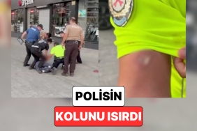 aydinda-kimligini-vermek-istemeyen-bir-sofor-tartisma-yasadigi-polisin-kolunu-isirdi-Fq9xSmnl.jpg