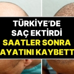 ingiltereden-turkiyeye-sac-ektirmeye-gelen-hasta-ameliyat-sonrasi-hayatini-kaybetti-7dXyjiZB.jpg
